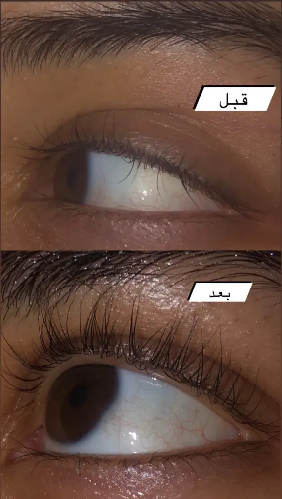Raw African Follicle Booster Eyelash Gel 8g.webp